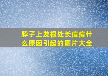 脖子上发根处长痘痘什么原因引起的图片大全