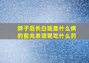 脖子后长白斑是什么病的前兆表现呢吃什么药