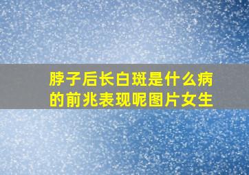 脖子后长白斑是什么病的前兆表现呢图片女生