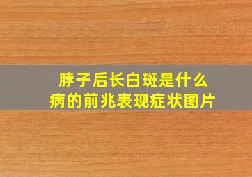 脖子后长白斑是什么病的前兆表现症状图片