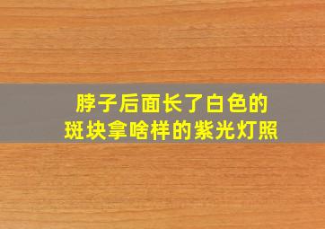 脖子后面长了白色的斑块拿啥样的紫光灯照