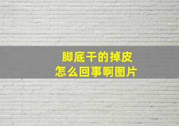 脚底干的掉皮怎么回事啊图片