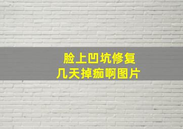 脸上凹坑修复几天掉痂啊图片