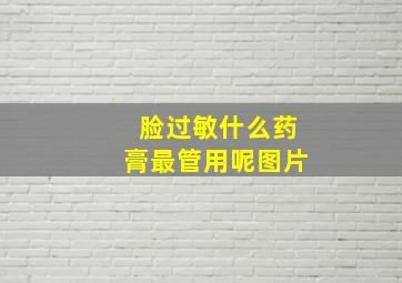 脸过敏什么药膏最管用呢图片