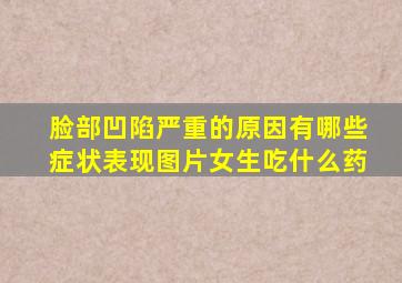 脸部凹陷严重的原因有哪些症状表现图片女生吃什么药