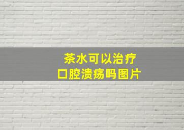 茶水可以治疗口腔溃疡吗图片