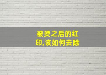 被烫之后的红印,该如何去除