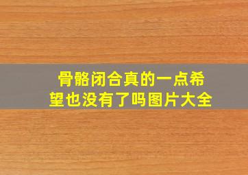 骨骼闭合真的一点希望也没有了吗图片大全