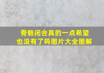 骨骼闭合真的一点希望也没有了吗图片大全图解