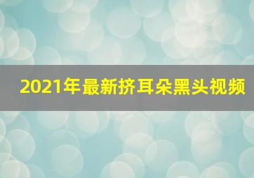 2021年最新挤耳朵黑头视频